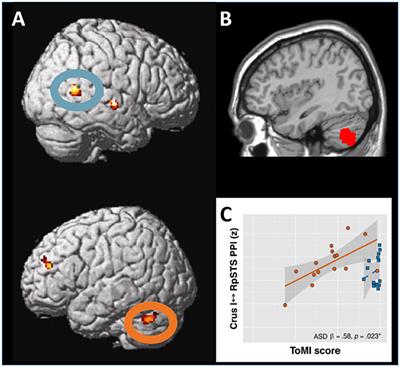 The Cerebellum in Social Cognition